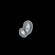 Verticillium dahliae — Soilborne pathogen · strawberry / cotton